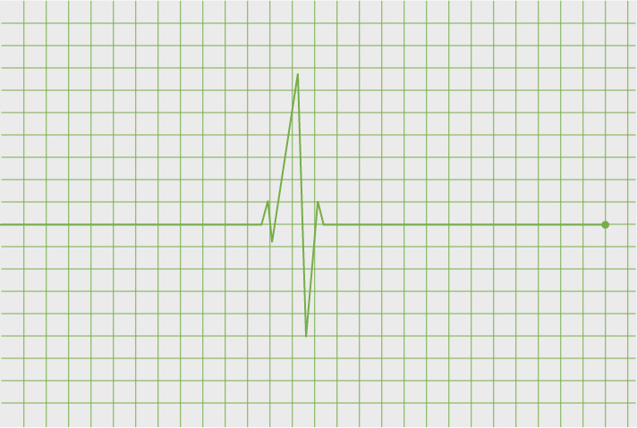 Schaubild: Herzfrequenz in Diagramm